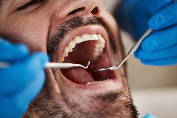 Best Emergency Treatment for Oral Infections in Greensboro, AL